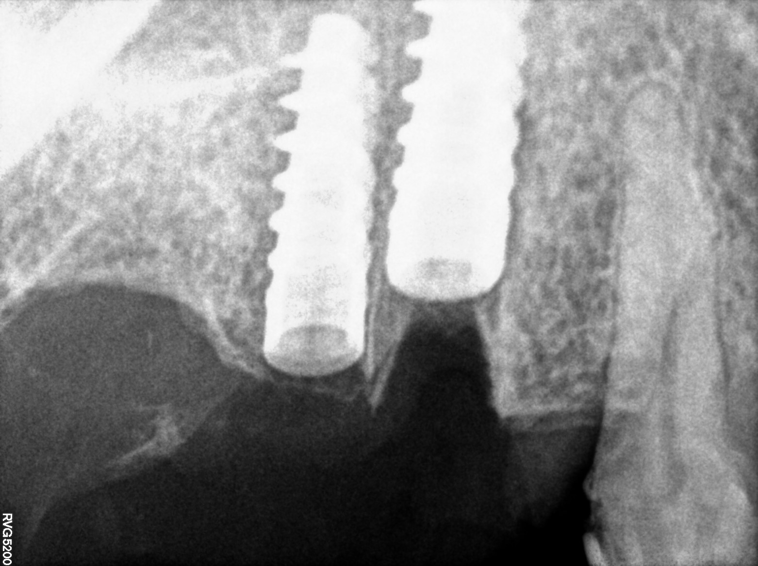 Dental X-ray